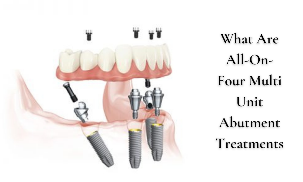 Multi Unit Abutment